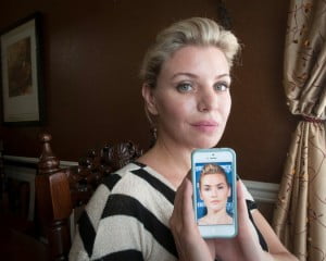 This patient wanted to look more like Kate Winslet. But doesn't she just look like Cameron Diaz?